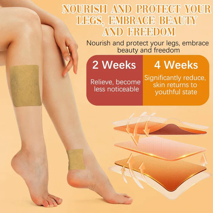 Varicose Vein Patches - Instant Relief (Pack of 10)