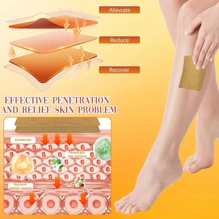 Varicose Vein Patches - Instant Relief (Pack of 10)