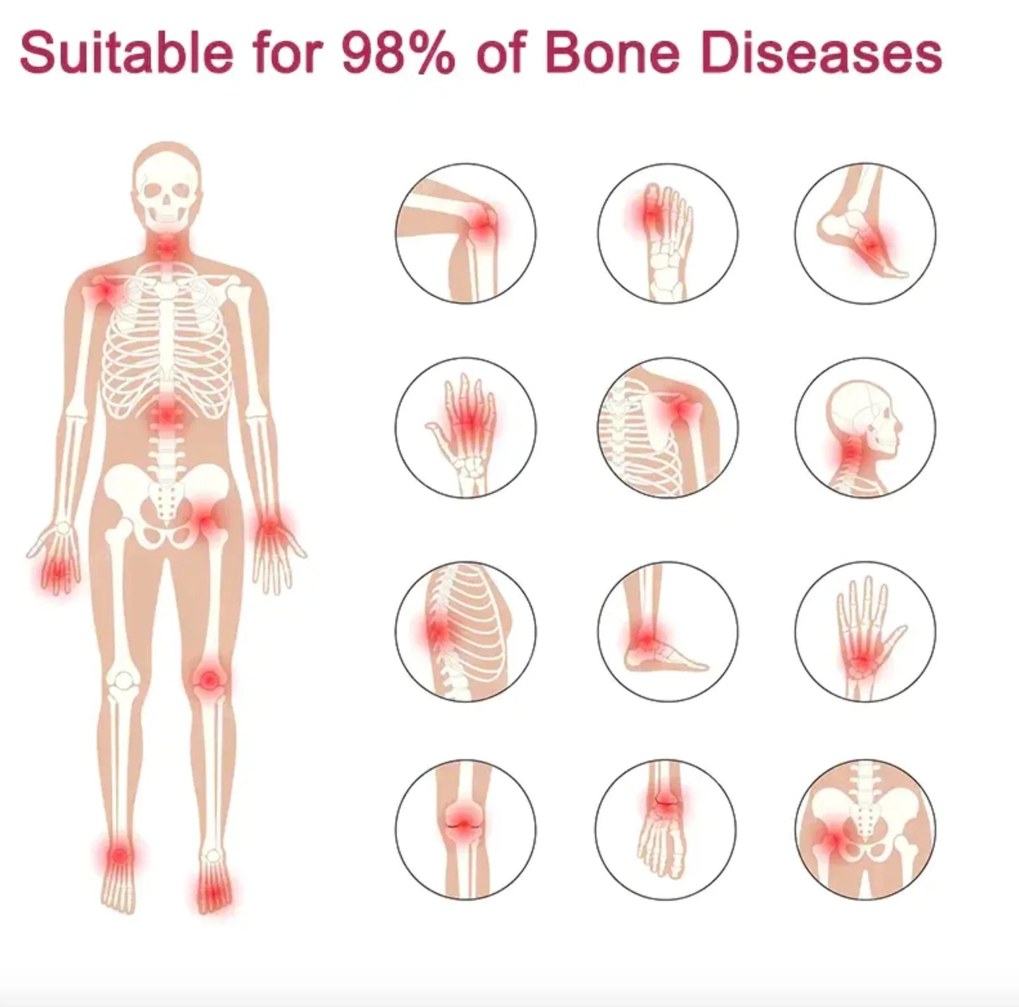Perfectx™ Joint & Bone Therapy Cream (Buy 1 Get 1 Free)