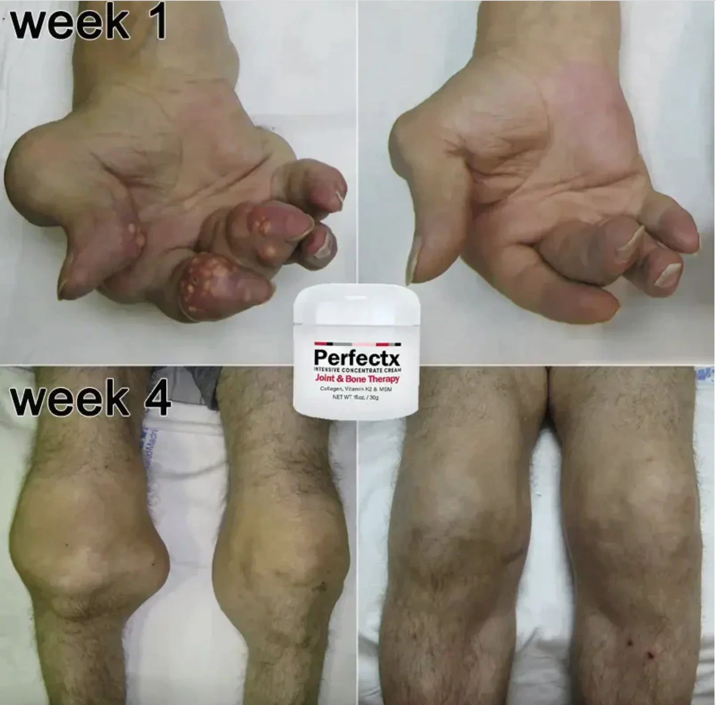 Perfectx™ Joint & Bone Therapy Cream (Buy 1 Get 1 Free)