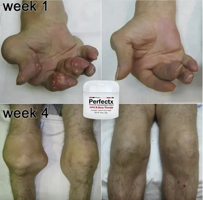 Perfectx™ Joint & Bone Therapy Cream (Buy 1 Get 1 Free)