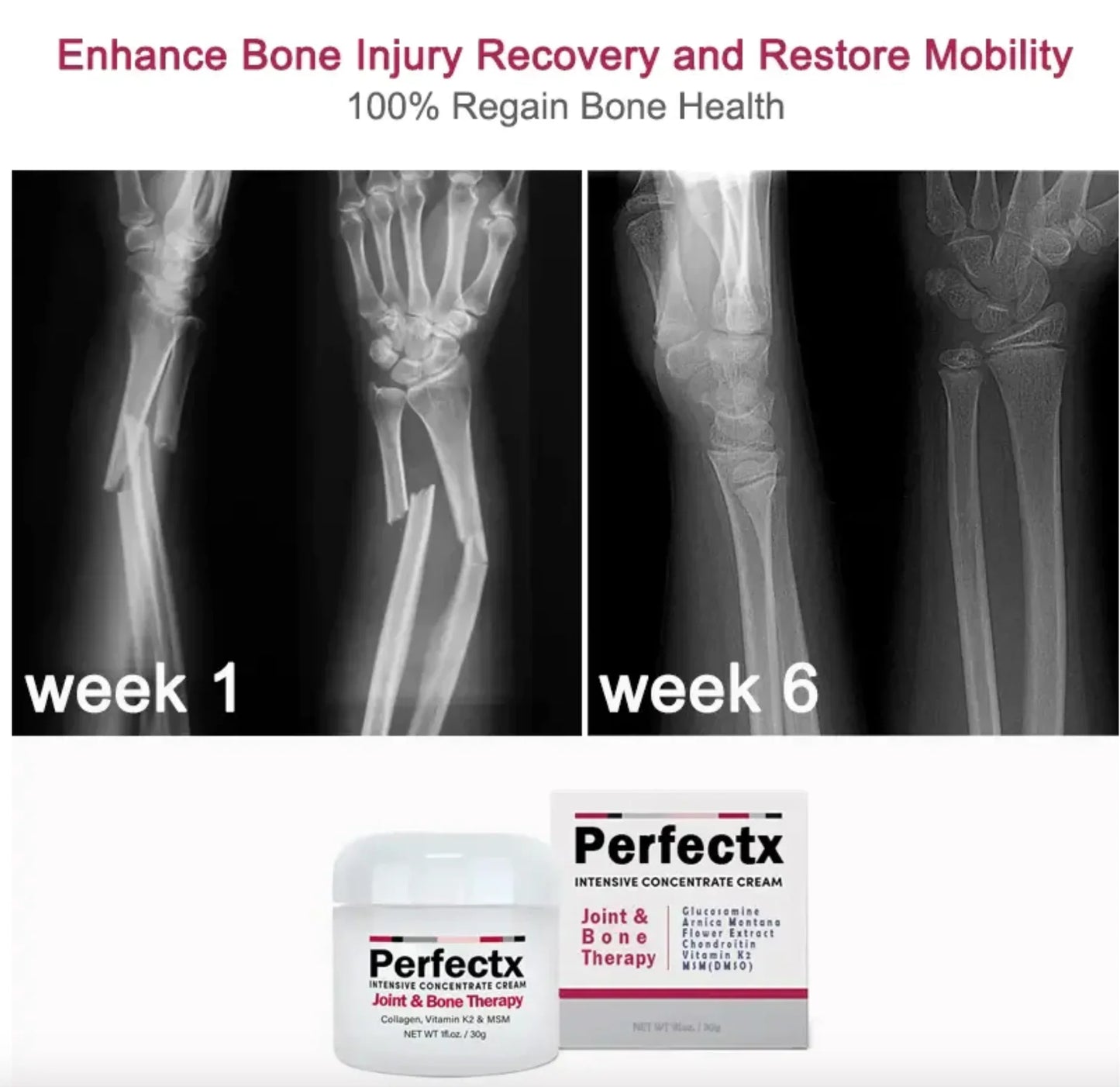 Perfectx™ Joint & Bone Therapy Cream (Buy 1 Get 1 Free)