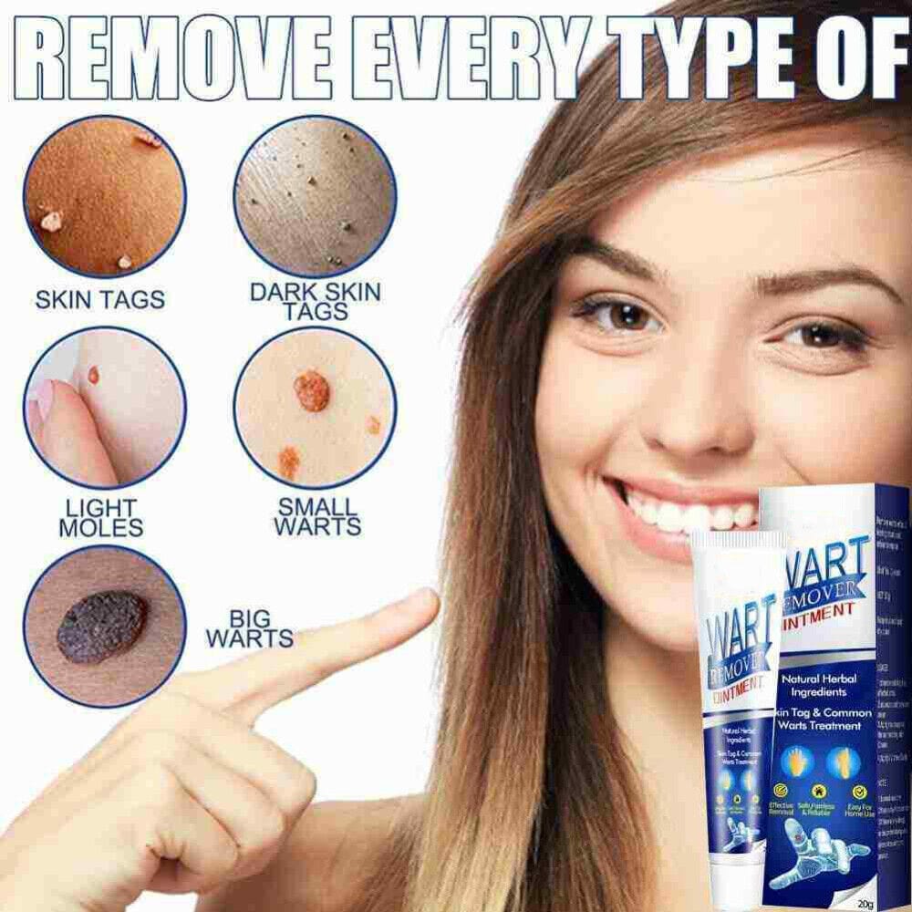 Wart Remover Instant Blemish Removal Cream (Buy 1 Get 1 Free)