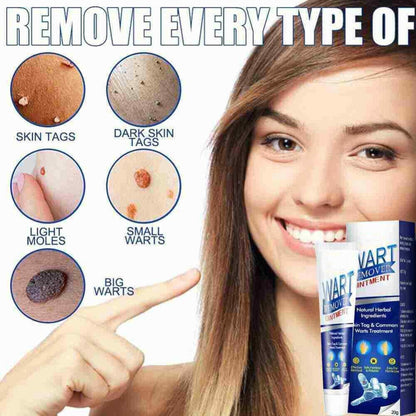 Wart Remover Instant Blemish Removal Cream (Buy 1 Get 1 Free)