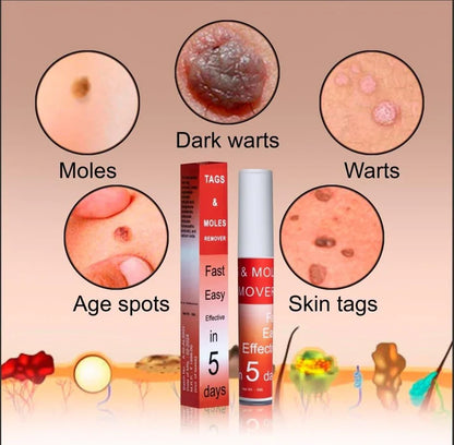 WipeOff Tags & Mole Remover (Buy 1 Get 1 Free)